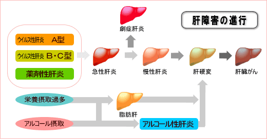 急性 劇 症 肝炎